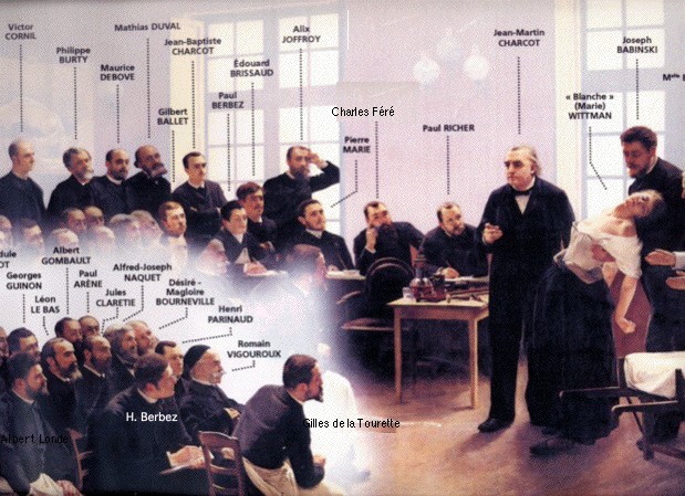 Enseignement de Charcot à la Salpêtrière : le professeur montrant à ses élèves sa plus fidèle patiente, « Blanche » (Marie) Wittman, en crise d’hystérie